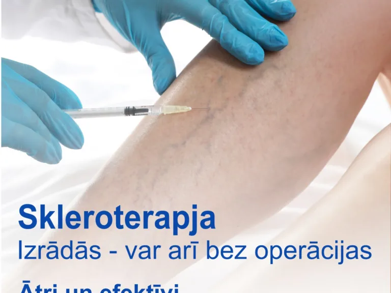 Pavasaris — labākais laiks parūpēties par kāju veselību un skaistumu